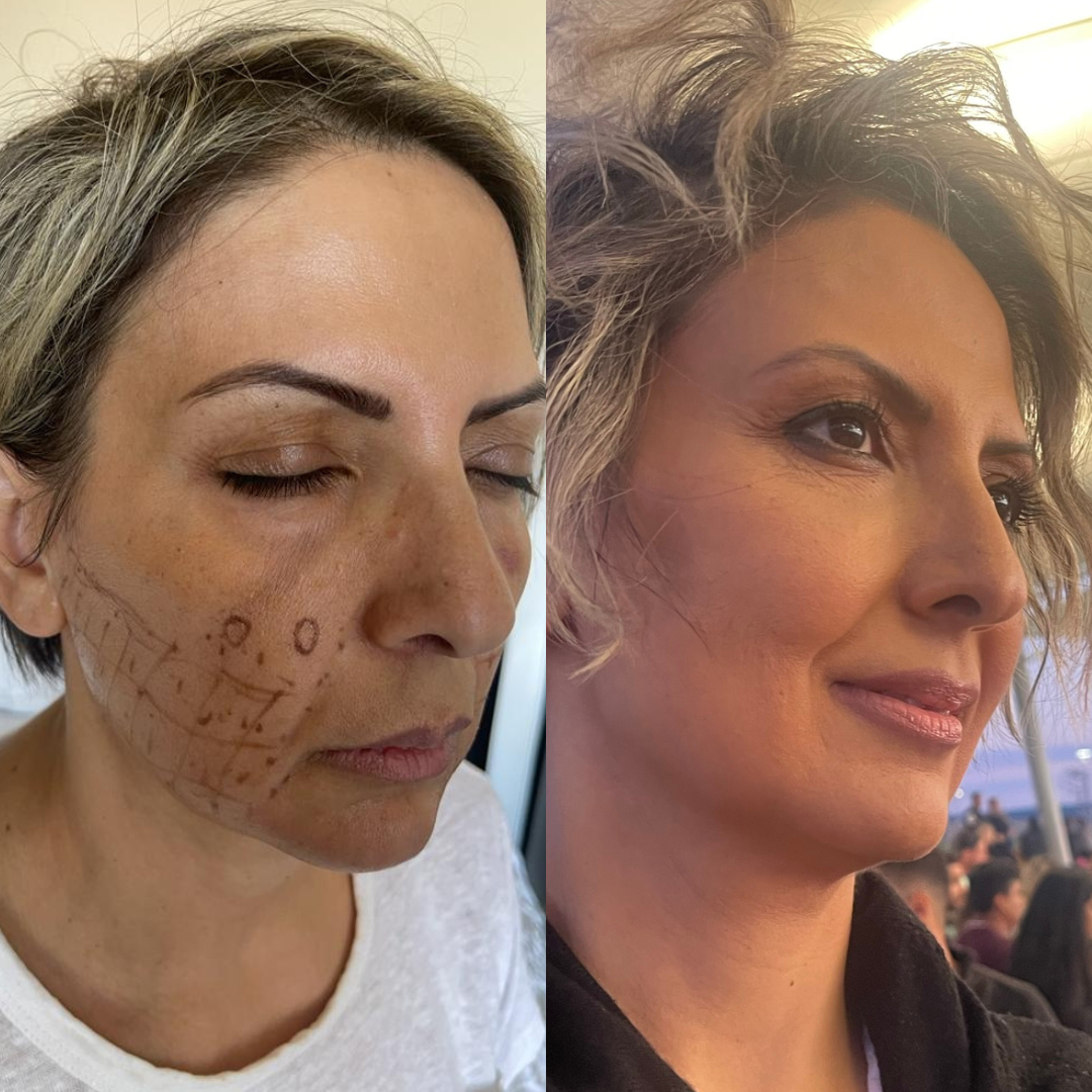 Prima e Dopo 1 — Villa Venus