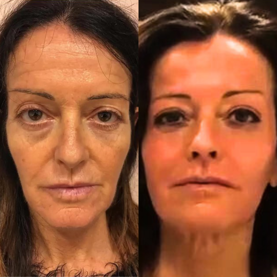 Prima e Dopo 2 — Villa Venus