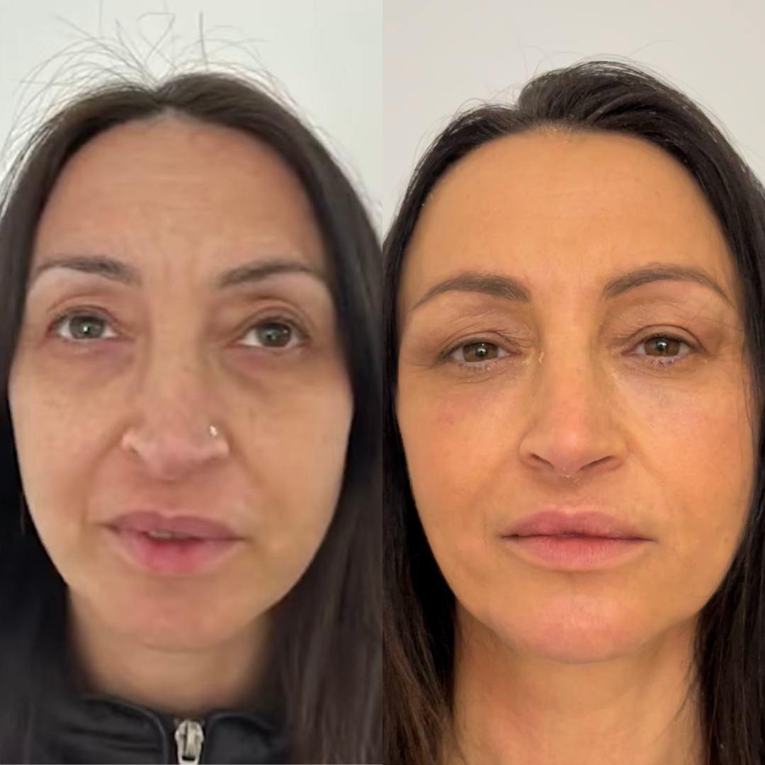 Prima e Dopo 4 — Villa Venus