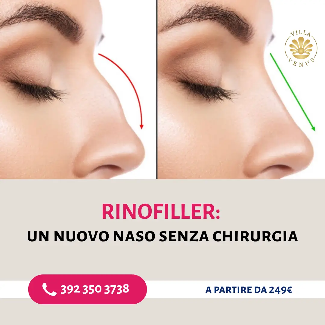 Rinofiller perugia empoli arezzo